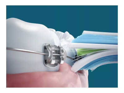 Електрическa четкa за зъби Sonicare 5500 Series HX7111, Черна - HX7111/01 gallery image 3